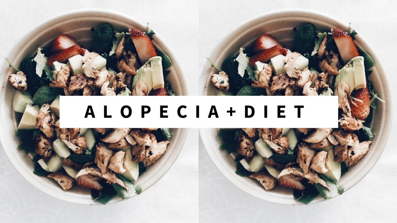 Best Diet Plan To Treat Alopecia Diet For Alopecia Areata
